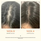 Growturn Hair Brush Serum l Clinically Proven for Visibly Fuller Hair & Healthy Scalp