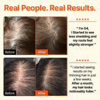 Growturn Hair Brush Serum l Clinically Proven for Visibly Fuller Hair & Healthy Scalp