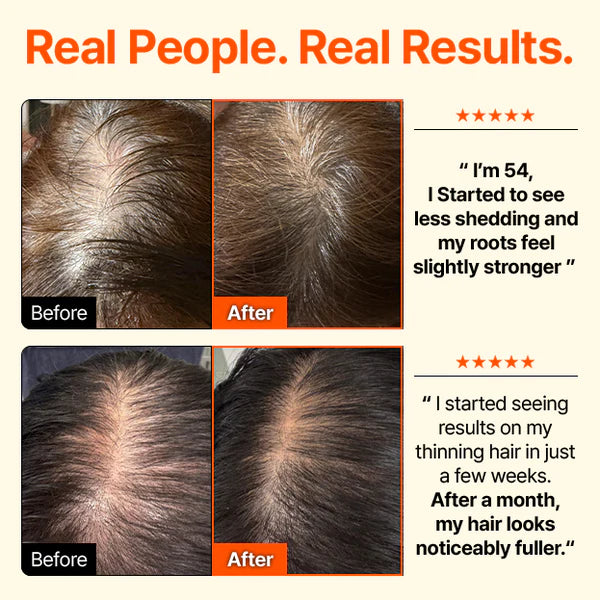 Growturn Hair Brush Serum l Clinically Proven for Visibly Fuller Hair & Healthy Scalp