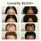 Usma Scalp Revival Bar