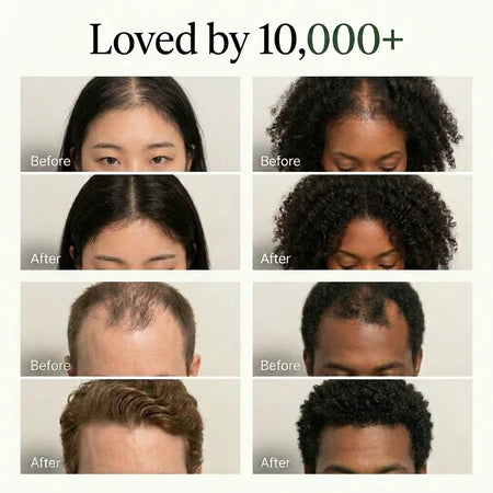 Usma Scalp Revival Bar