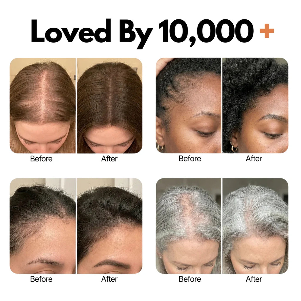 Growturn Hair Brush Serum l Clinically Proven for Visibly Fuller Hair & Healthy Scalp