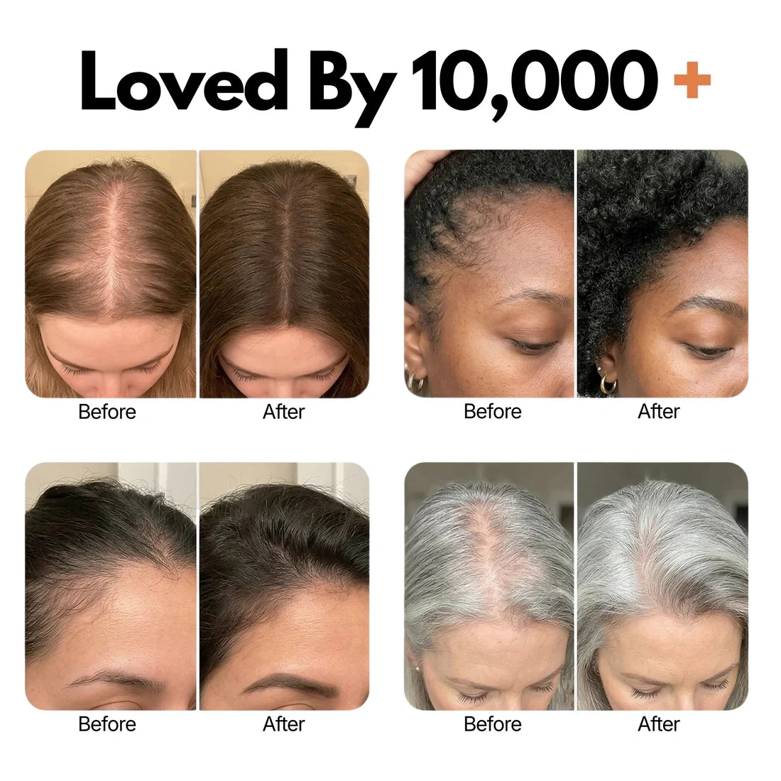 Growturn Hair Brush Serum l Clinically Proven for Visibly Fuller Hair & Healthy Scalp