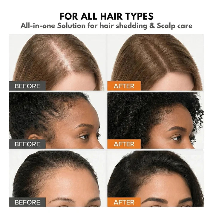Growturn Hair Brush Serum l Clinically Proven for Visibly Fuller Hair & Healthy Scalp