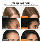 Growturn Hair Brush Serum l Clinically Proven for Visibly Fuller Hair & Healthy Scalp